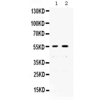XRCC4 Antibody (aa49-75)