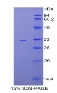 Mouse SERPINA7 / TBG Protein (Recombinant His)