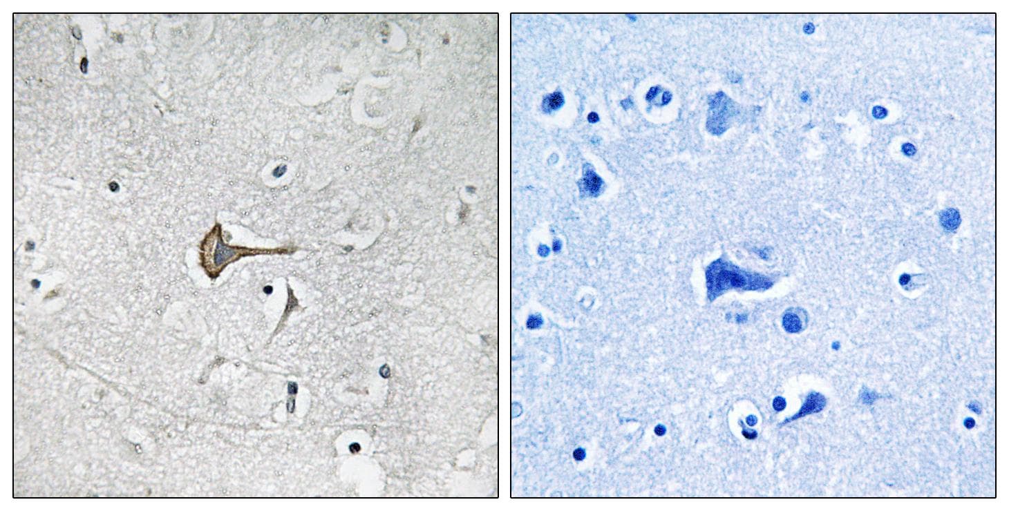 KCND2 / Kv4.2 Antibody (Ab-616)