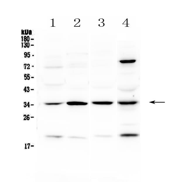 Polyclonal Rabbit anti-Human STUB1 / CHIP Antibody (IHC, WB)