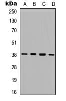 PRKAB1 / AMPK Beta 1 Antibody (Internal)