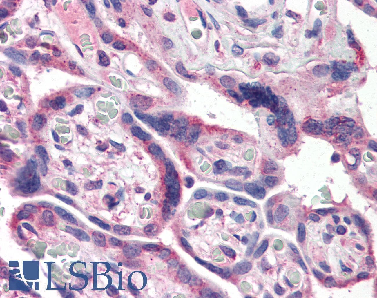 IHC-plus™ Monoclonal Rat anti-Human NFKB1 / NF-Kappa-B Antibody (clone NF5E6, aa1-15, IHC, WB)