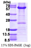 Human HDAC2 Protein (Recombinant His, C-Terminal)