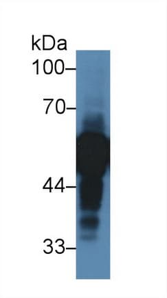 AHSG / Fetuin A Antibody (aa19-300, Cy3)