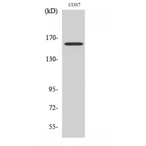 RAB3GAP2 / p150 Antibody (390-470 aa, Internal)
