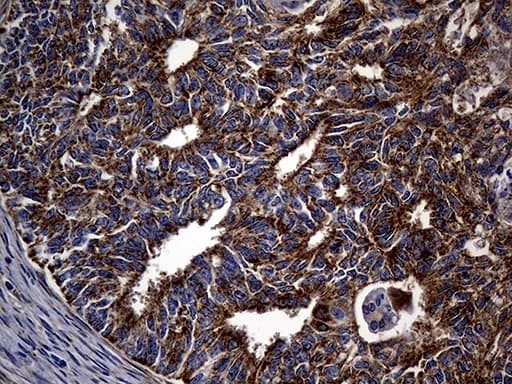 ALDH7A1 Antibody (clone OTI1A9, Carrier-free)