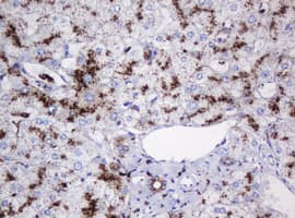 GLB1 / Beta-Galactosidase Antibody (clone OTI1C9)