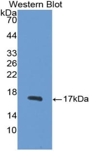 SNCG / Gamma-Synuclein Antibody (aa1-123)