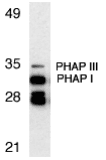 Gestrinone Antibody
