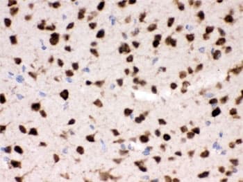 ELAVL4 / HuD Antibody