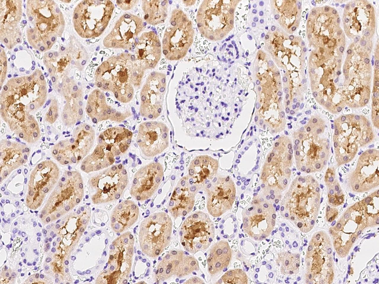 AMDHD2 Antibody