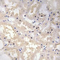 VIP Antibody (Internal)