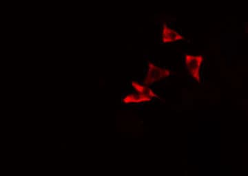 RHPN1 / RHOPHILIN Antibody