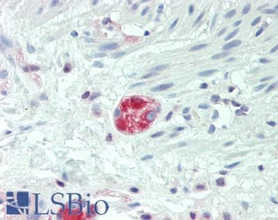 IHC-plus™ Polyclonal Rabbit anti-Human DHRS4L2 Antibody (aa132-158, IHC, WB)