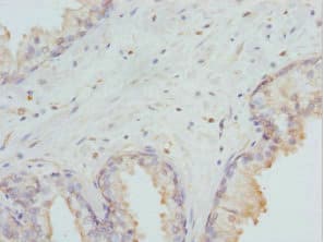 Polyclonal Rabbit anti-Human DLX2 Antibody (IHC)