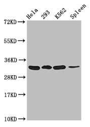 HIST1H1E Antibody (phospho-Thr17)