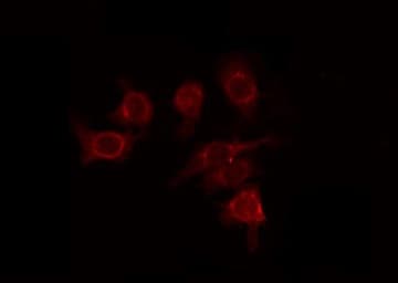 GLI / GLI1 Antibody