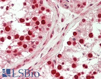 IHC-plus™ TESK2 Antibody (Internal)