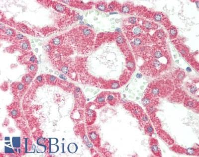 IHC-plus™ PI3 / Elafin Antibody
