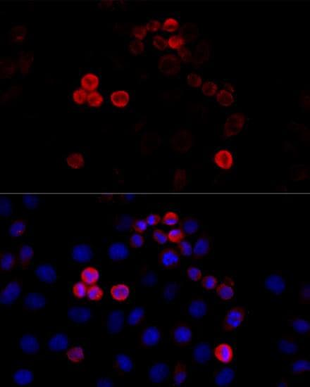 FLNA / Filamin A Antibody