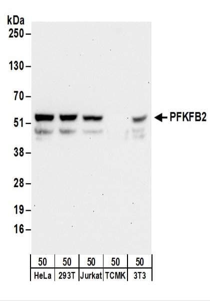PFKFB2 Antibody (aa455-505)