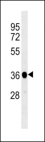 Polyclonal Rabbit anti-Human PPP1CB Antibody (aa276-304, WB)