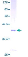 Human CHURC1 Protein (Recombinant GST)