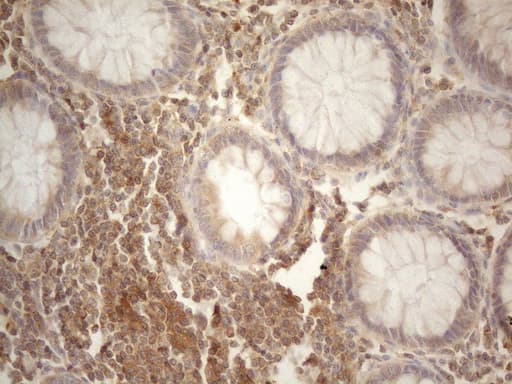 Monoclonal Mouse anti-Human CD40 Antibody (clone OTI9F4, Carrier-free, aa21-166, IHC, WB)