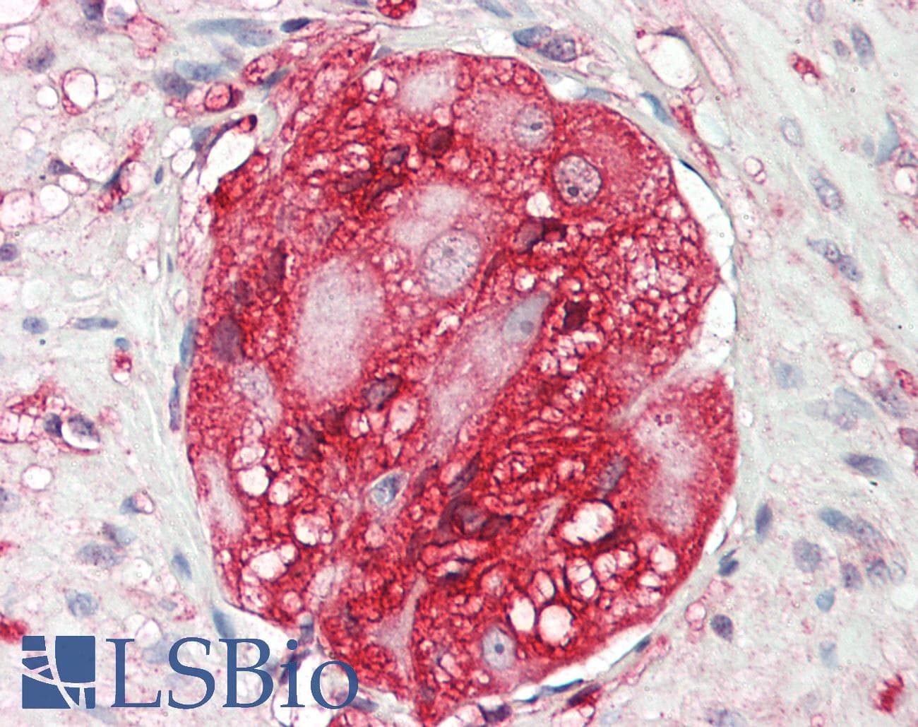 IHC-plus™ MAPRE2 / EB2 Antibody (aa300-350)