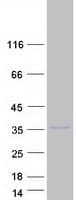 Human ANKRD16 Protein (Recombinant Myc-DDK (Flag))