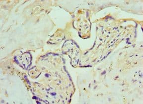 CSRP2BP Antibody (aa523-782)