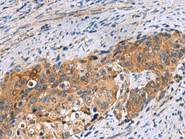 JOSD1 Antibody