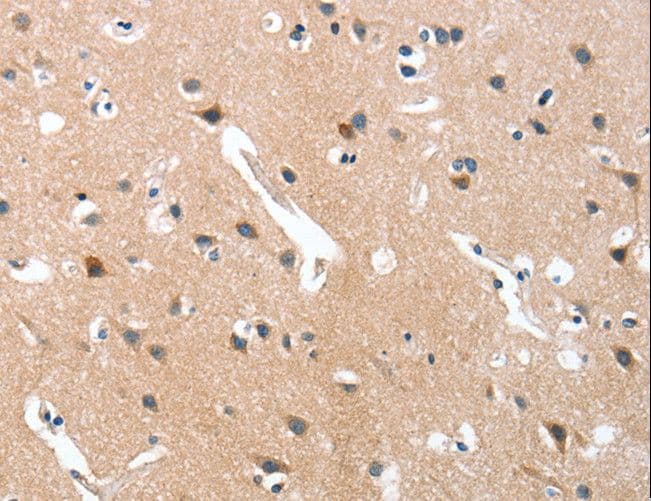 Polyclonal Rabbit anti-Human GRB7 Antibody (IHC)