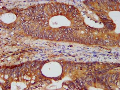 Polyclonal Rabbit anti-Human KTN1 / Kinectin Antibody (IHC, WB)