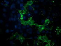 IHC-plus™ PDE2A Antibody (clone 5B10)