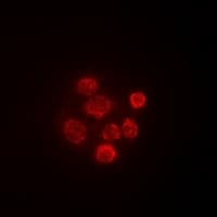 SECISBP2 / SBP2 Antibody