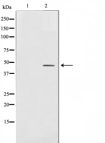 TFAP2A + TFAP2B Antibody
