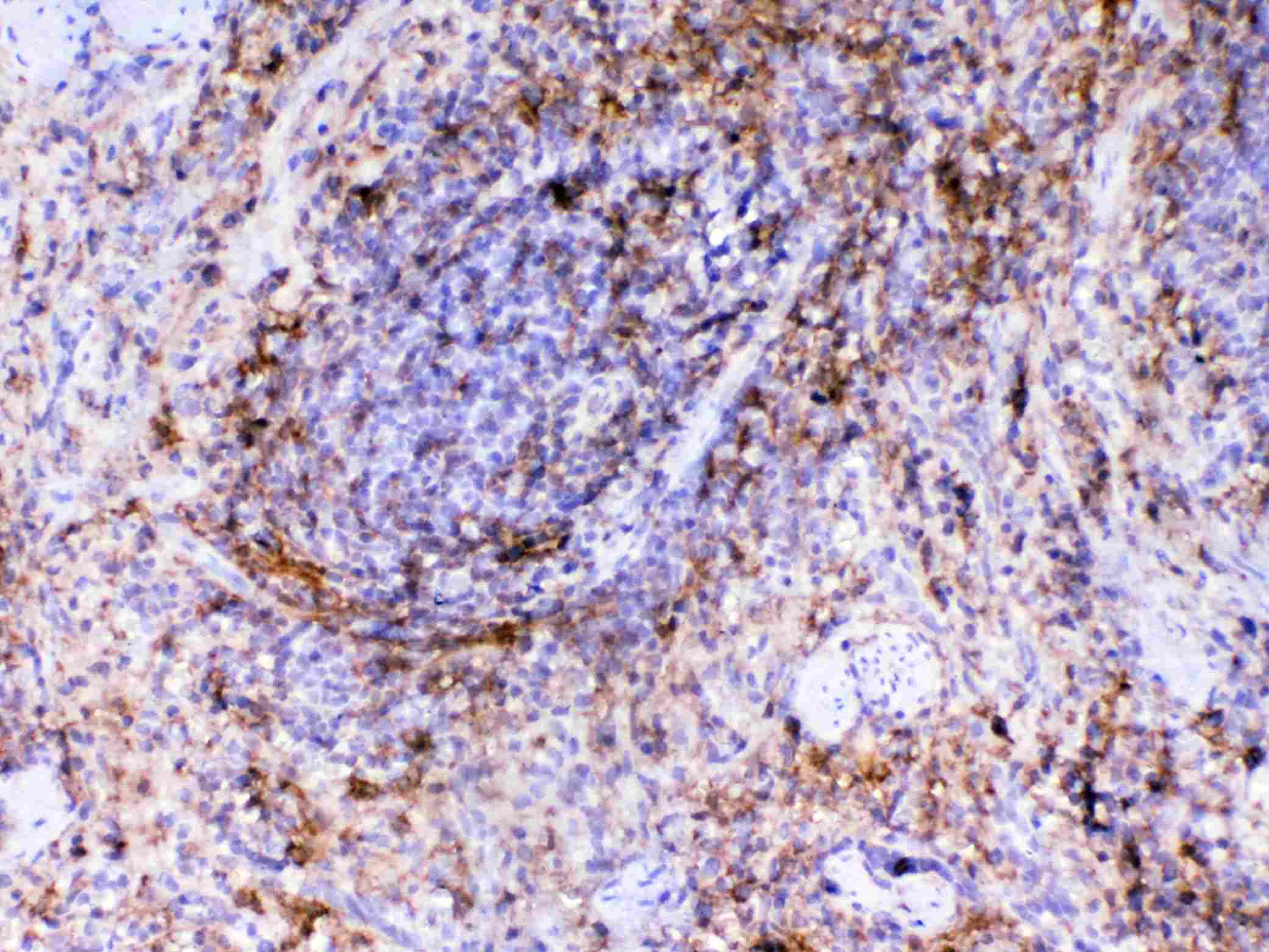 VCAM1 / CD106 Antibody