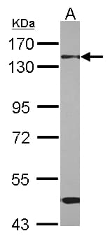 RBM26 / SE70 Antibody (Internal)
