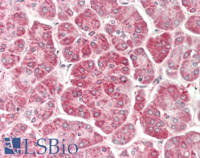 IHC-plus™ ACVR1B / ALK4 Antibody (Internal)