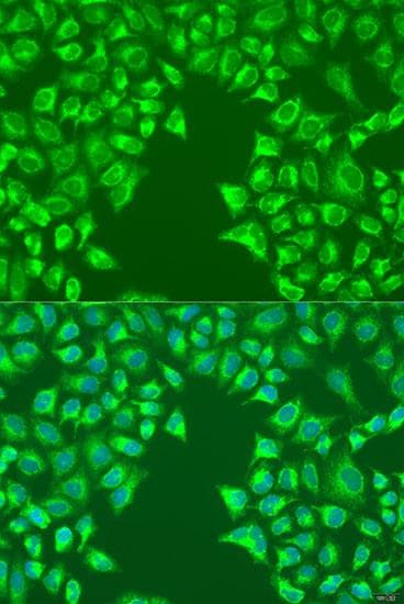 LRP6 Antibody