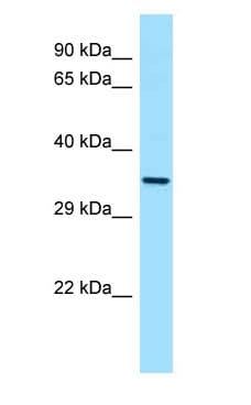 CTSL / Cathepsin L Antibody (aa194-243)