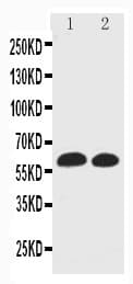 SLC1A3 / EAAT1 Antibody (aa519-537)