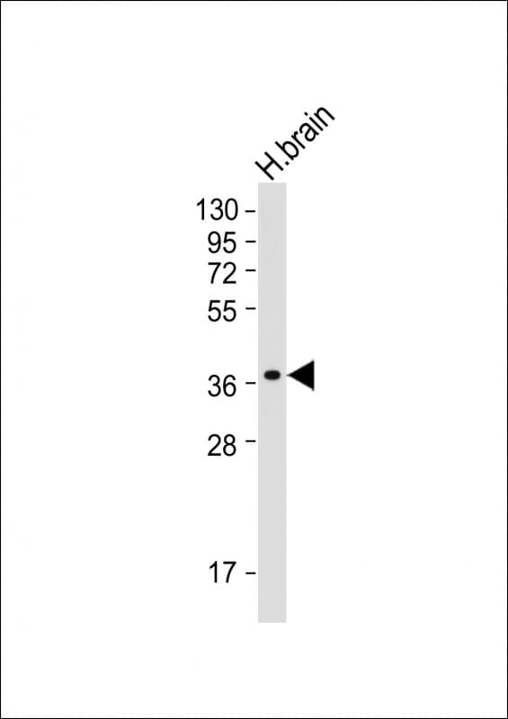 MIR16 / GDE1 Antibody (clone 2021CT823.61.7)