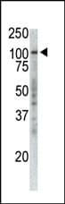 IHC-plus™ TPX2 Antibody (clone 19AT738.292)