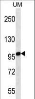 IHC-plus™ STIM2 Antibody (aa98-127)