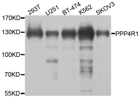 Polyclonal Rabbit anti-Human PPP4R1 / PP4R1 Antibody (IHC, WB)