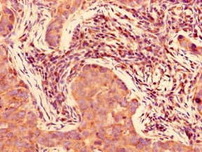 Polyclonal Rabbit anti-Human FAM160A2 / C11orf56 Antibody