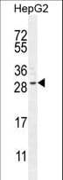 CCDC153 Antibody (aa32-60)