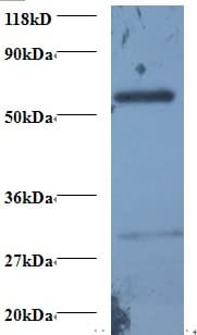 PSMB7 Antibody